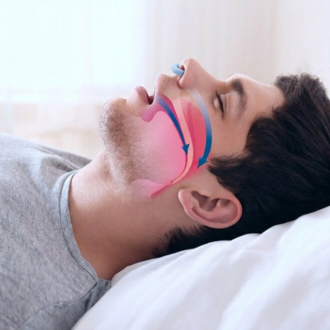 SleepZee image